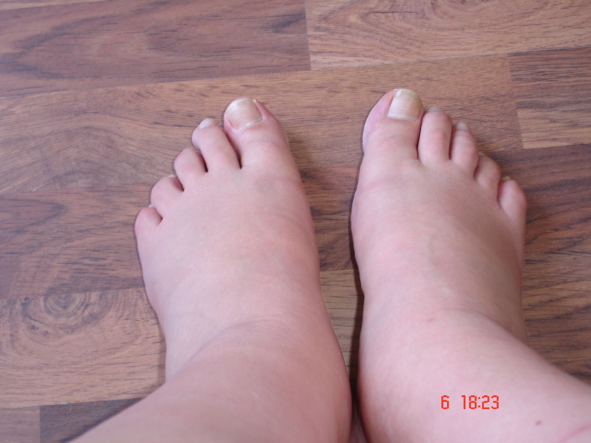 Mes Pieds